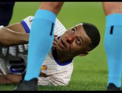 Cidera Patah Hidung, Mbape Bakal Absen di Sisa Laga Fase Group Euro 2024