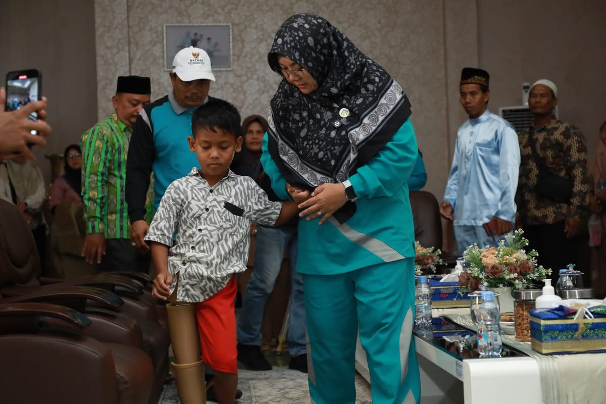 Bupati Siak Wujudkan Janji, Yuda Kembali Bisa Berjalan dengan Kaki Palsu