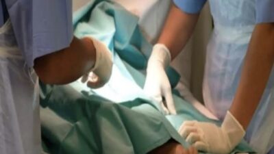 Bidan Desa yang Buat Putus Kepala Rudal Bocah Saat Sunat Ditetapkan Polisi Pelalawan Sebagai Tersangka