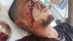 Pria di Inhu Bacok Wajah Pemuda hingga Bersimbah Darah, Begini Kronologinya Pria di Inhu Bacok Wajah Pemuda hingga Bersimbah Darah, Begini Kronologinya