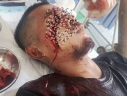 Pria di Inhu Bacok Wajah Pemuda hingga Bersimbah Darah, Begini Kronologinya