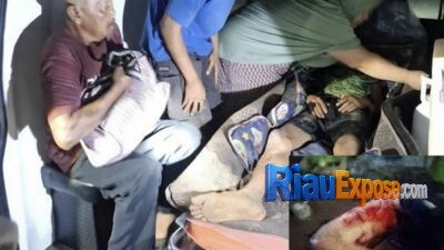 Pekerja di Sungai Apit Siak Diterkam Harimau Sumatera Saat Buang Air, Korban Selamat